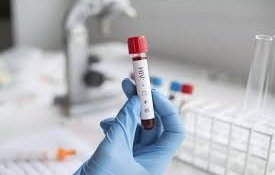 HIV Treatment