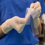 Hernia Mesh Price in Bangladesh