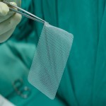 Inguinal Hernia Mesh; 2 Types Synthetic Polymer Biological Mesh Elastic Durable