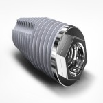 External Hex Specifications and How to Buy in Bulk