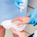 isopropyl alcohol for wounds buying guide with special conditions and exceptional price