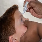 isopropyl alcohol in eye with complete explanations and familiarization