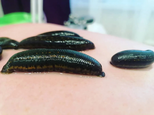 قیمت و خرید زالو طبی سبز  + فروش ارزان