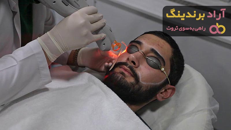 خرید دستگاه لیزر خانگی + قیمت عالی با کیفیت تضمینی