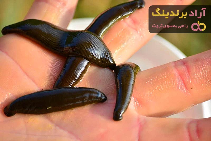 زالو درمانی برای لک صورت | قیمت مناسب خرید عالی