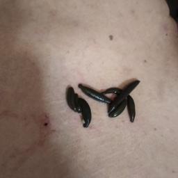 زالوی طبی سبز + قیمت خرید، کاربرد، مصارف و خواص