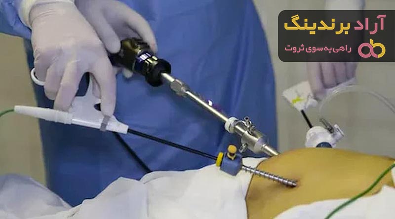 قیمت دستگاه ساکشن چربی شکم