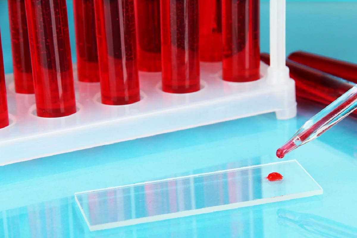 جیوه قرمز در کجای رادیو قدیمی است