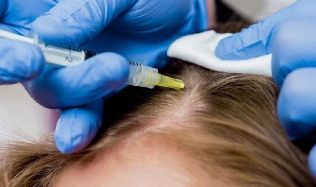 قیمت دستگاه مزوتراپی مو