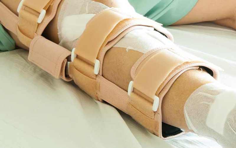 آتل کششی؛ کاهش درد منبسط شدن عضلات مناسب ران پا