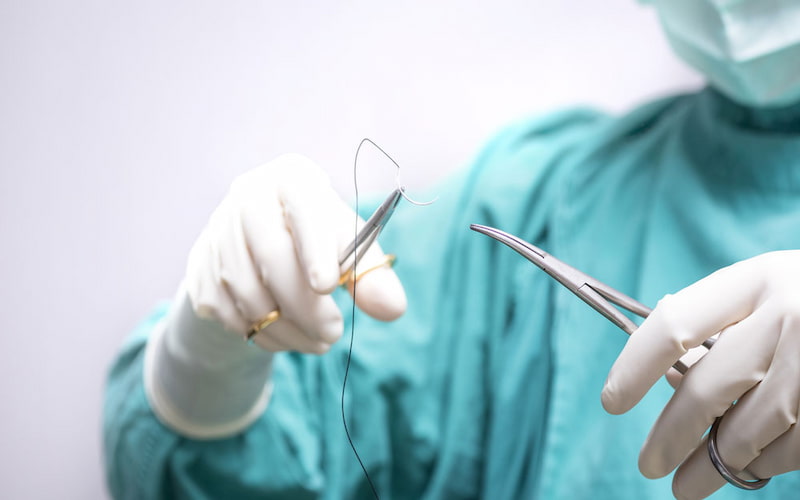 نخ مونوفیلامنت جراحی؛ تک چند رشته ای مناسب بخیه ظریف