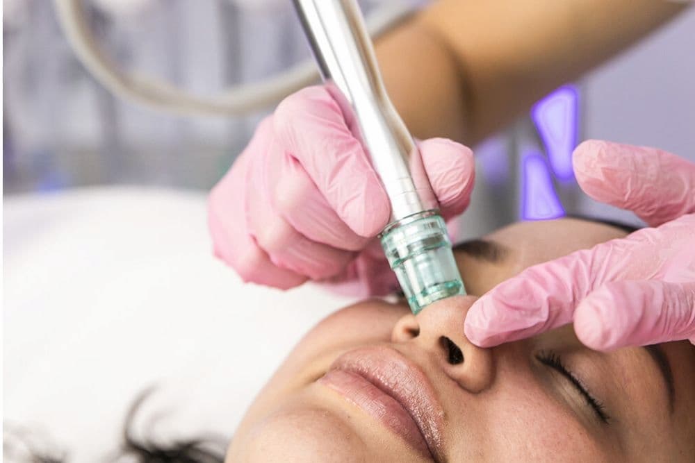 میکرودرم برای منافذ باز پوست؛ فرانسه صاف کننده صورت سالن آرایشی