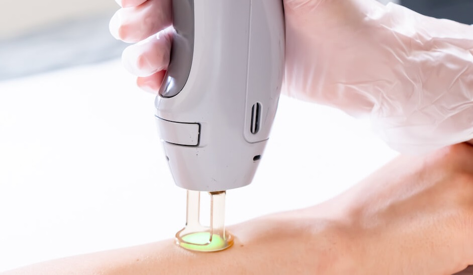 دستگاه لیزر الکس شاتی؛ پاکسازی موی زائد سیستم خنک کننده تولید iran