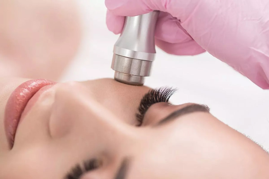 میکرودرم عمیق؛ خانگی لایه بردار افزایش کلاژن microdermabrasion