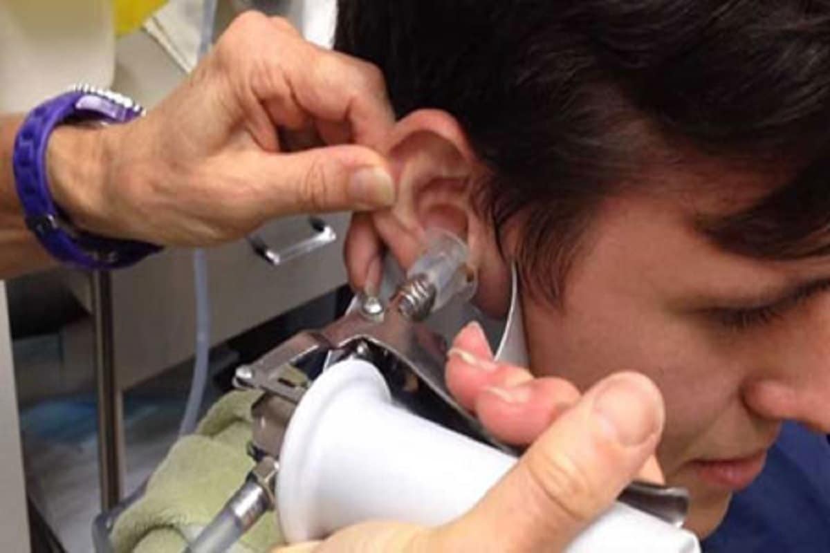 دستگاه ساکشن جرم گوش؛ برطرف کننده خارش سایز (12 25) خانگی