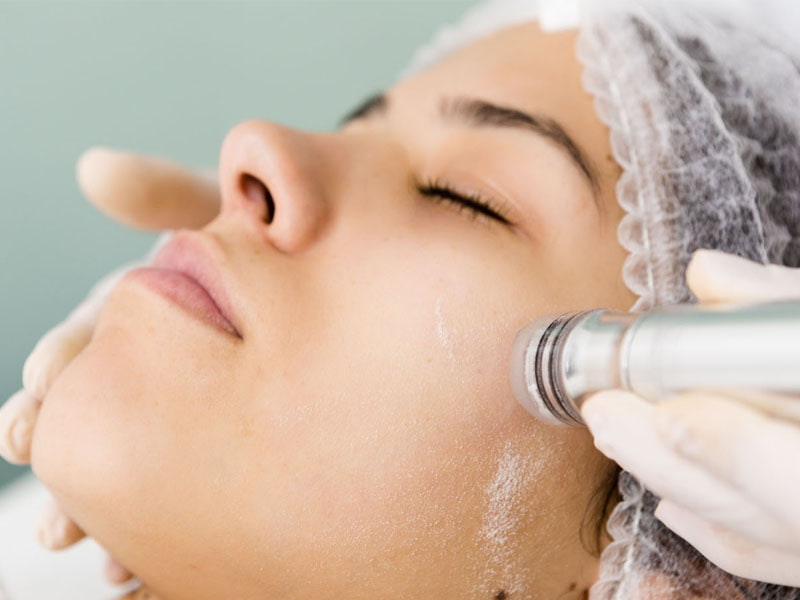 میکرودرم صورت در بارداری؛ سفید نقره ای ضایعات پوستی 2 نوع برقی دستی