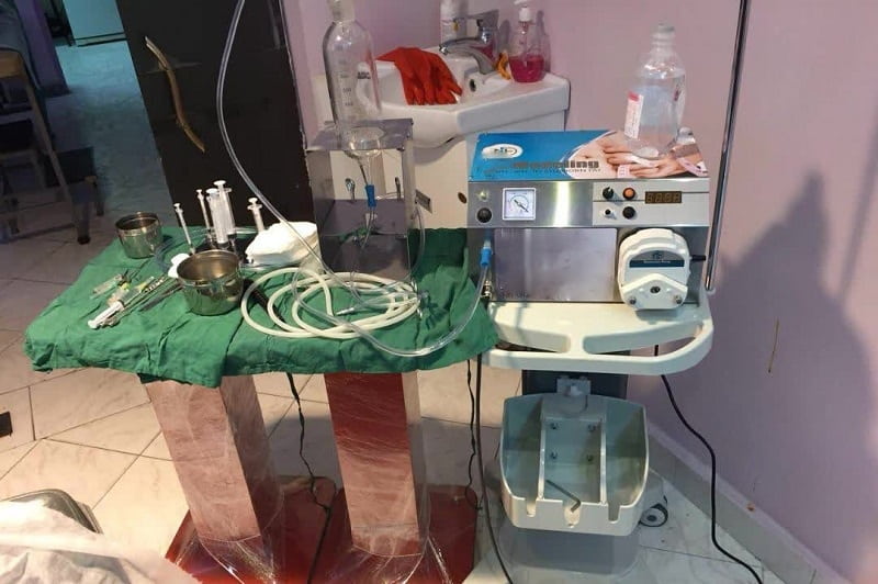 دستگاه ساکشن تزریق چربی؛ کاهش افزایش موضعی (صورت بدن) device
