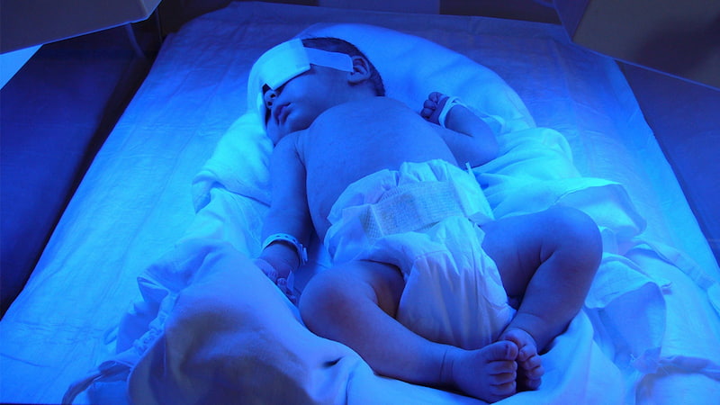 لامپ مهتابی زردی نوزاد (فلورسنت) بی خطر باکیفیت آبی فتوتراپی LED