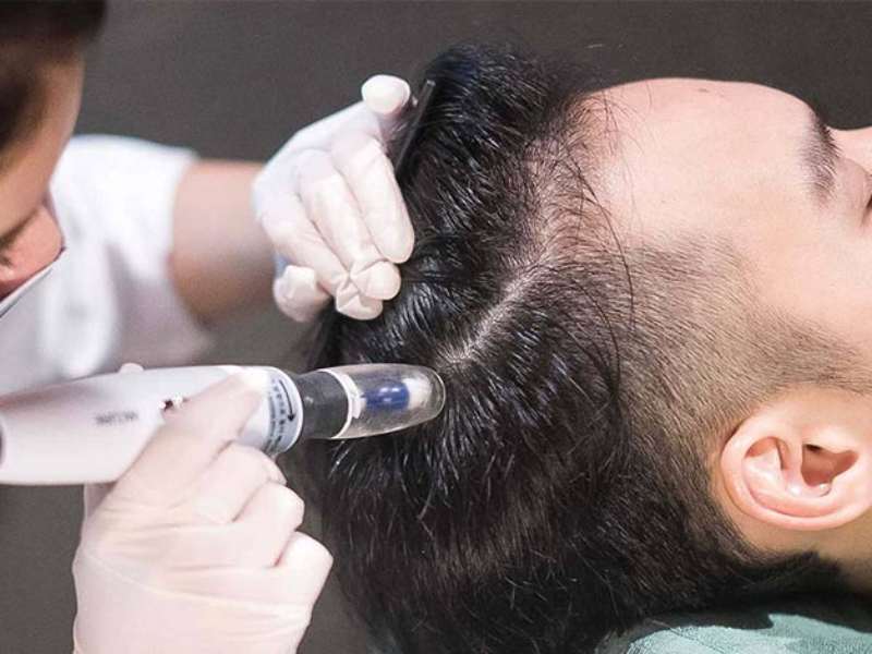 خرید دستگاه مزوتراپی پوست خانگی + بهترین قیمت