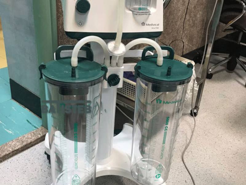 خرید دستگاه ساکشن چربی صورت + قیمت عالی