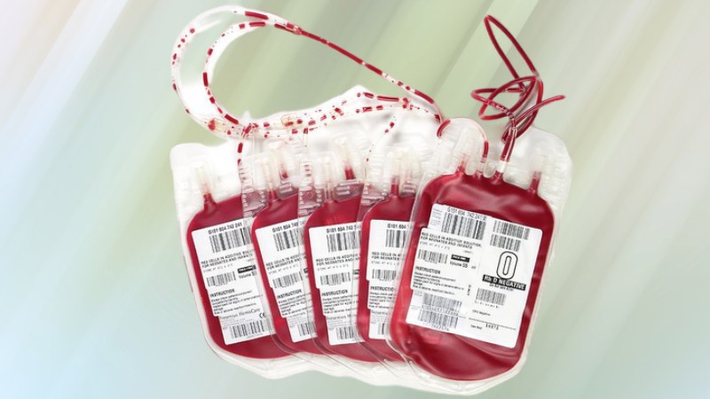 کیسه فصد خون فارمد؛ یکبارمصرف مقاومت فوق العاده 350 میلی‌لیتر