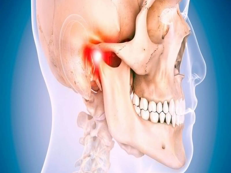 قیمت و خرید ایمپلنت تمام فک بالا + فروش ارزان