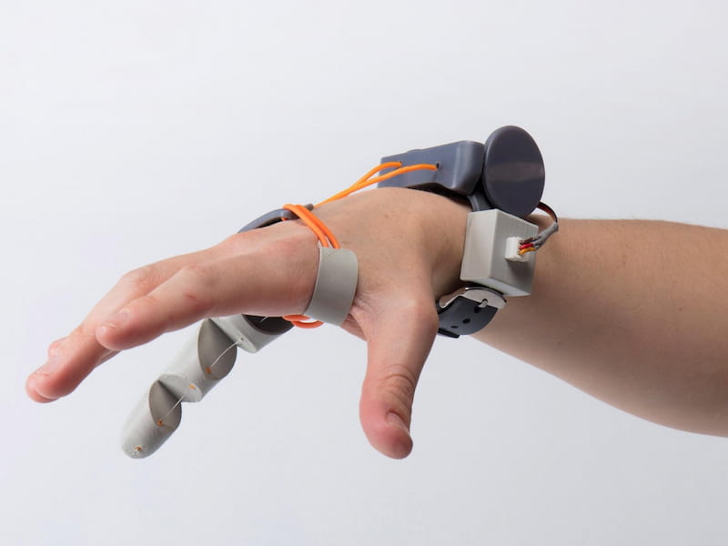 خرید انواع ایمپلنت انگشت دست + قیمت