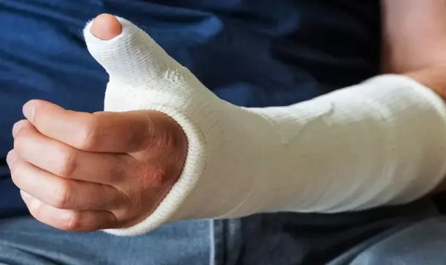 لیست قیمت آتل گچی دست 1402