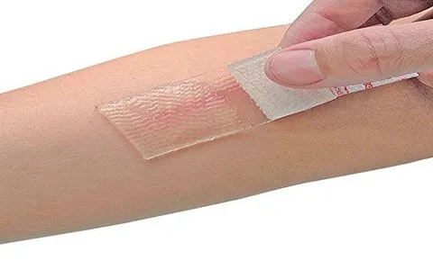 چسب سیلیکونی برای جای بخیه؛ نفوذ ناپذیری 10 سایز بی رنگ کرمی قرمز سبز