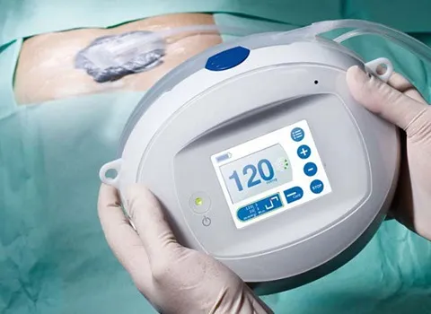 دستگاه ساکشن زخم بستر؛ خارج کردن ترشحات قابل حمل Npwt