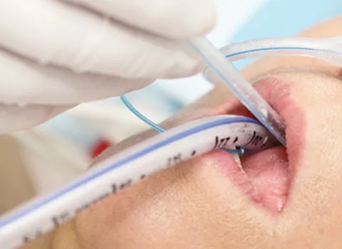 قیمت دستگاه ساکشن حلق