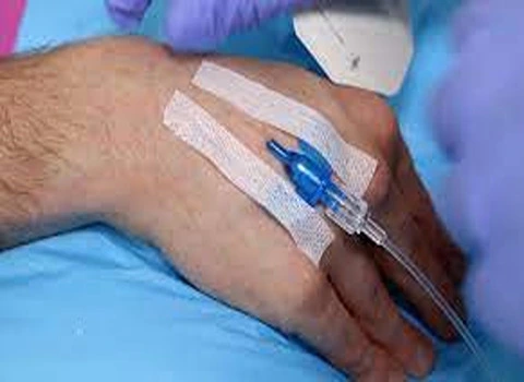 قیمت خرید چسب آنژیوکت حصیری + خواص، معایب و مزایا