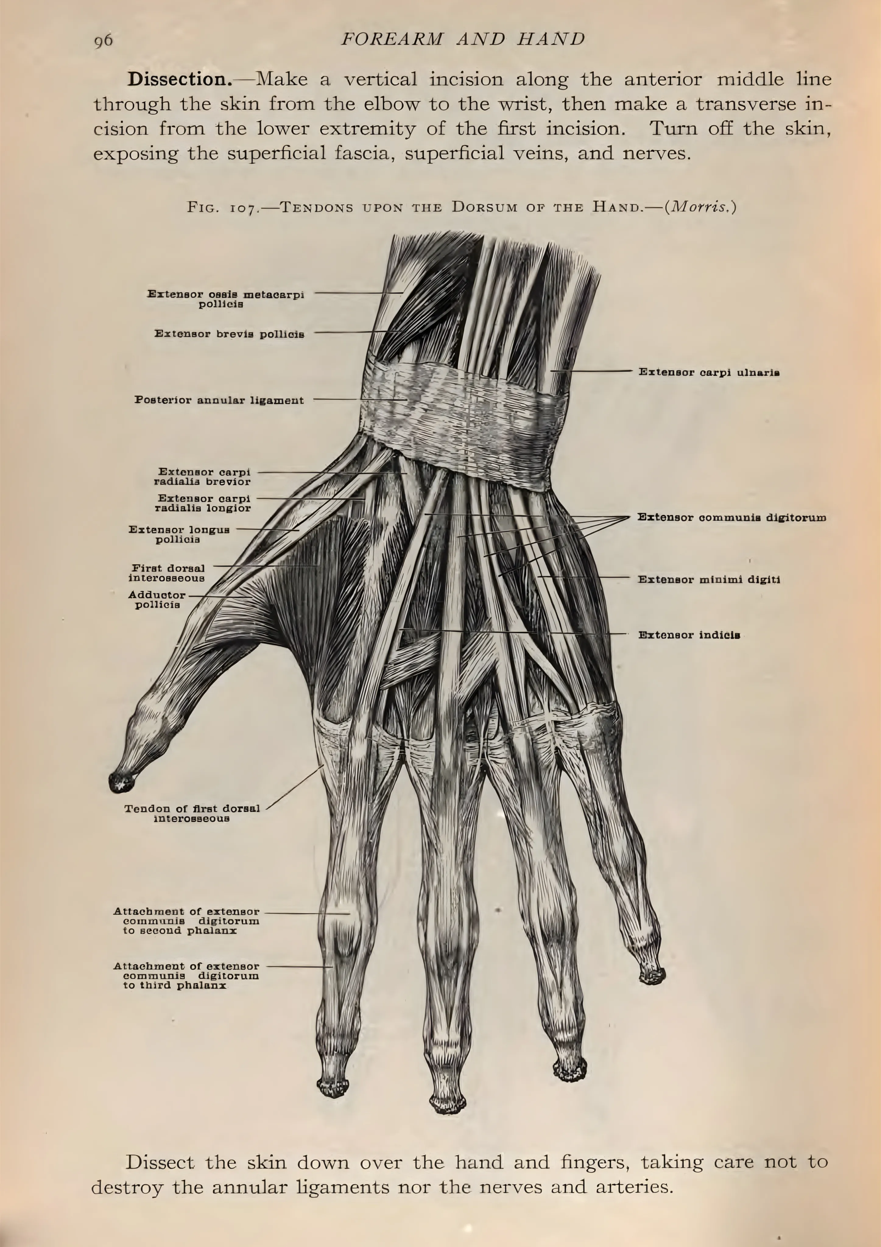 Tendons Upon the Dorsum of the Hand image 1