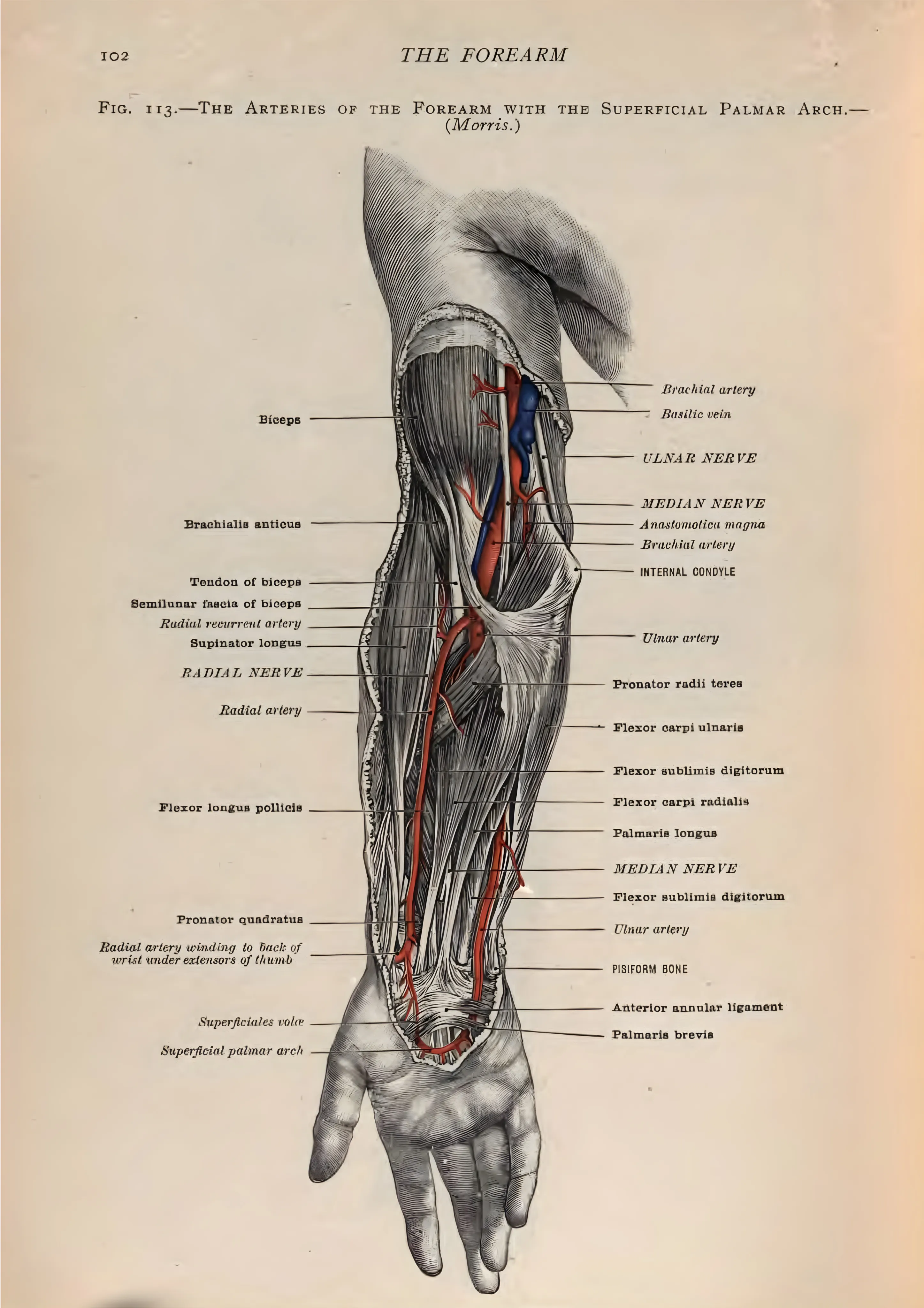 The Arteries of the Forearm with the Superficial Palmar Arch image 1