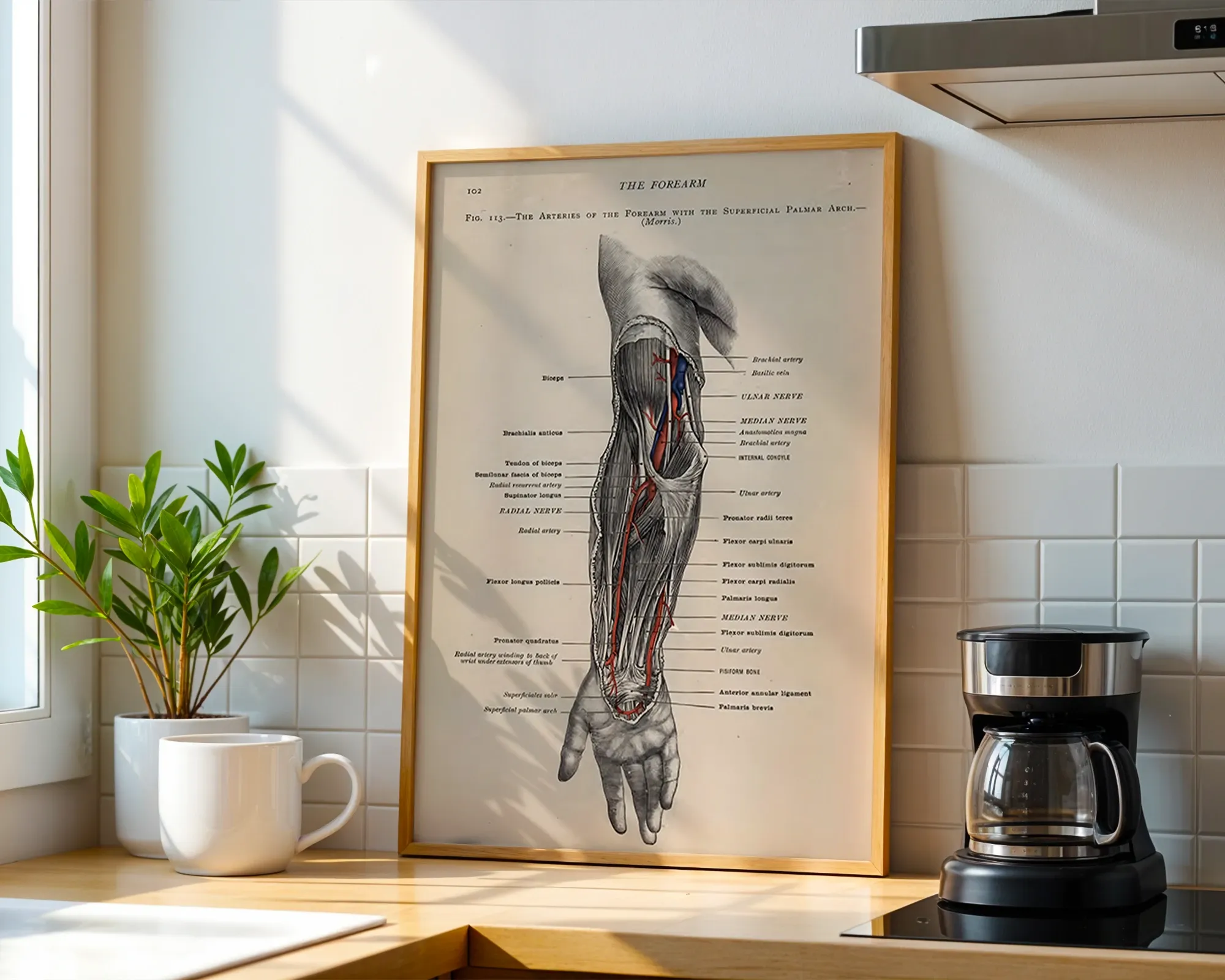 The Arteries of the Forearm with the Superficial Palmar Arch — room view 1