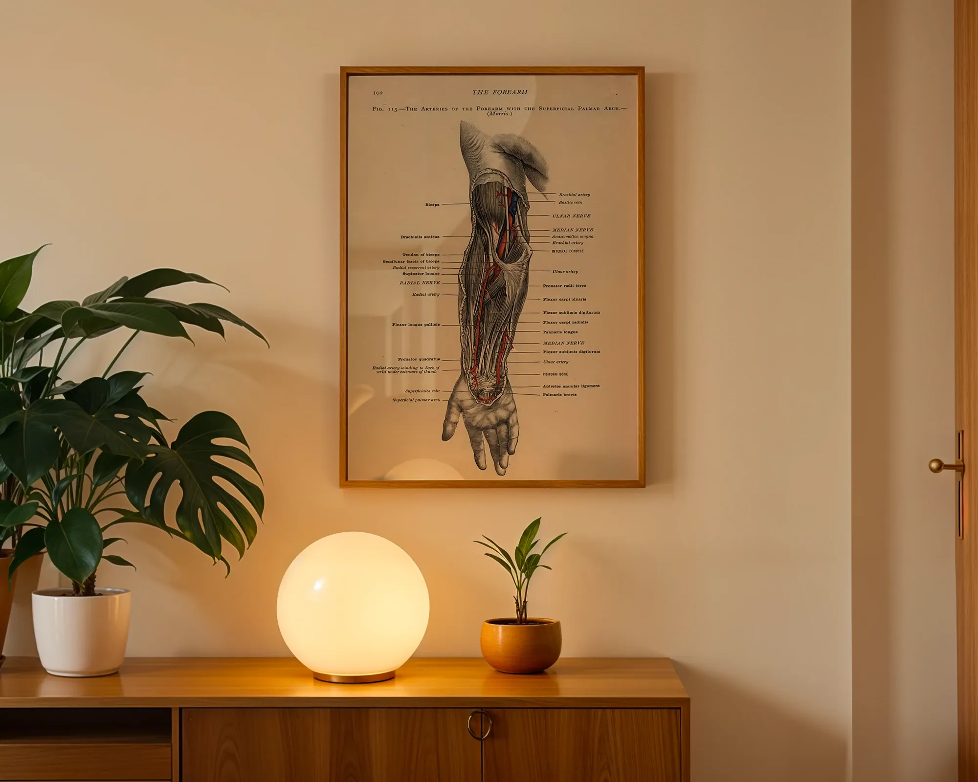 The Arteries of the Forearm with the Superficial Palmar Arch — room view 3