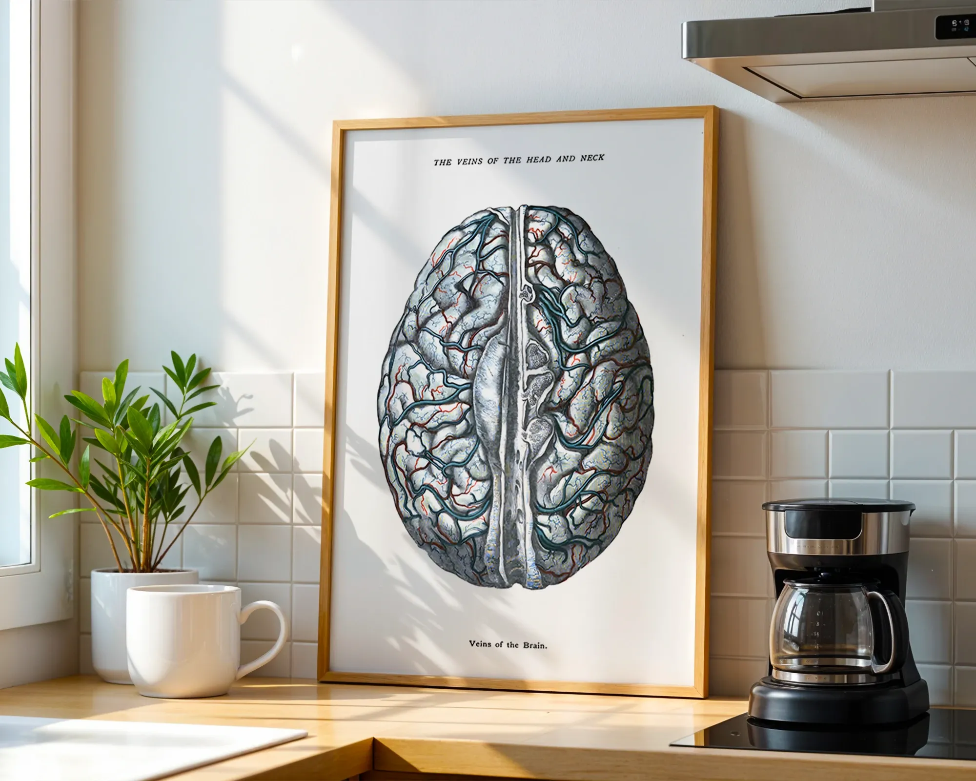 Veins of the Brain — room view 1
