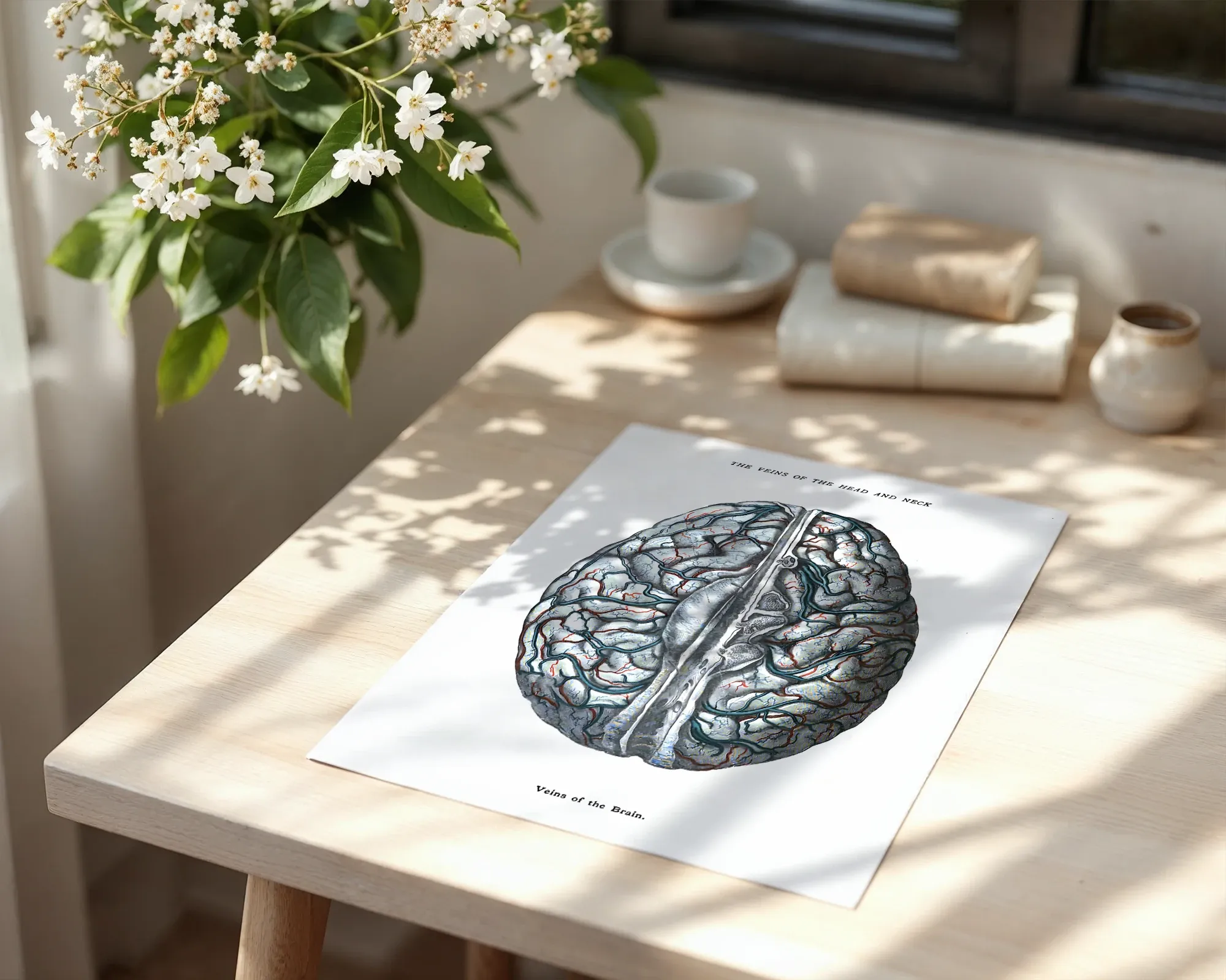 Veins of the Brain — room view 6