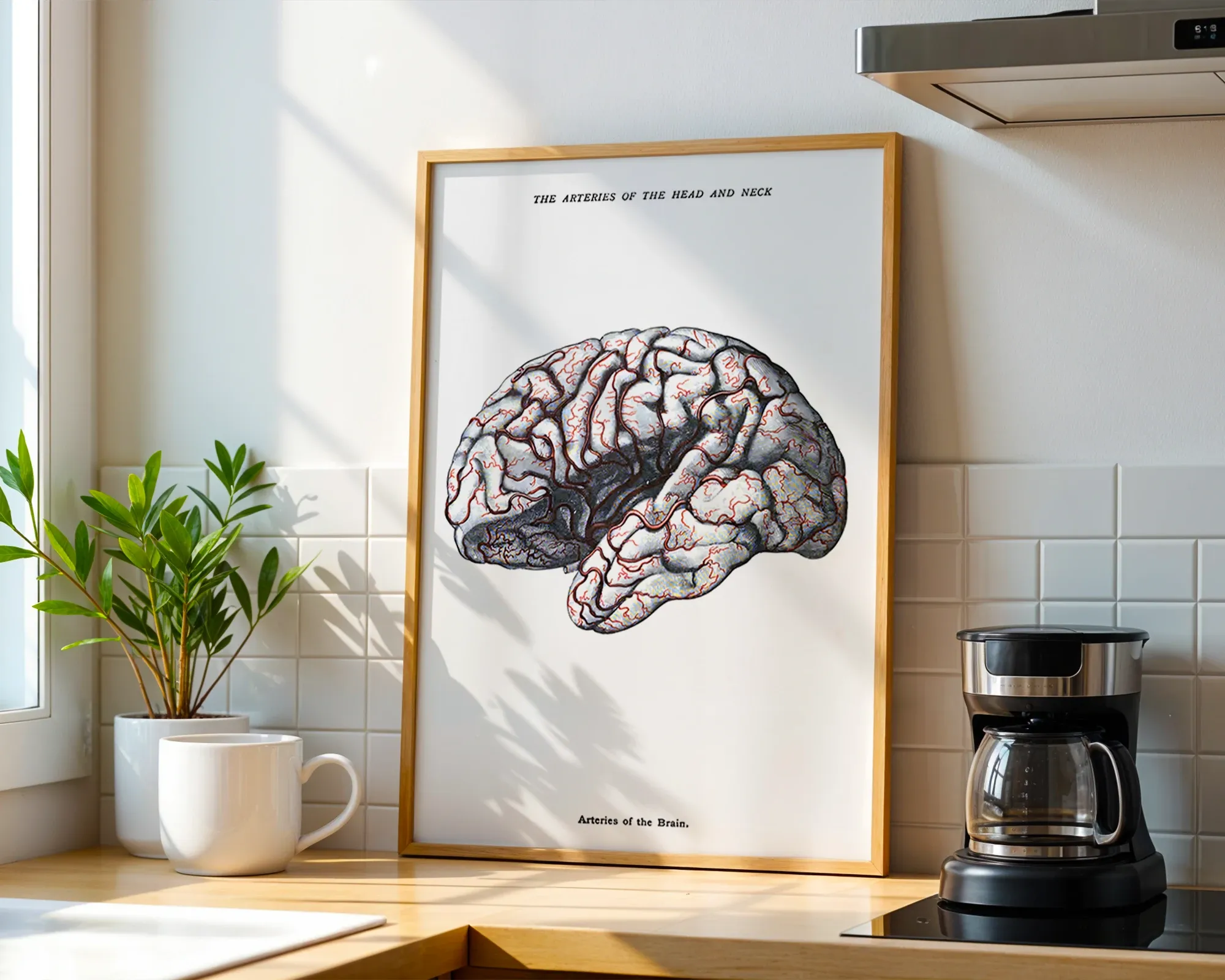 Arteries of the Brain — room view 1