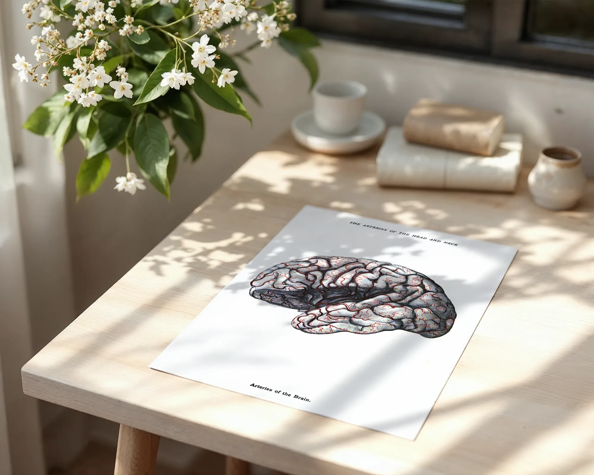 Arteries of the Brain — room view 6