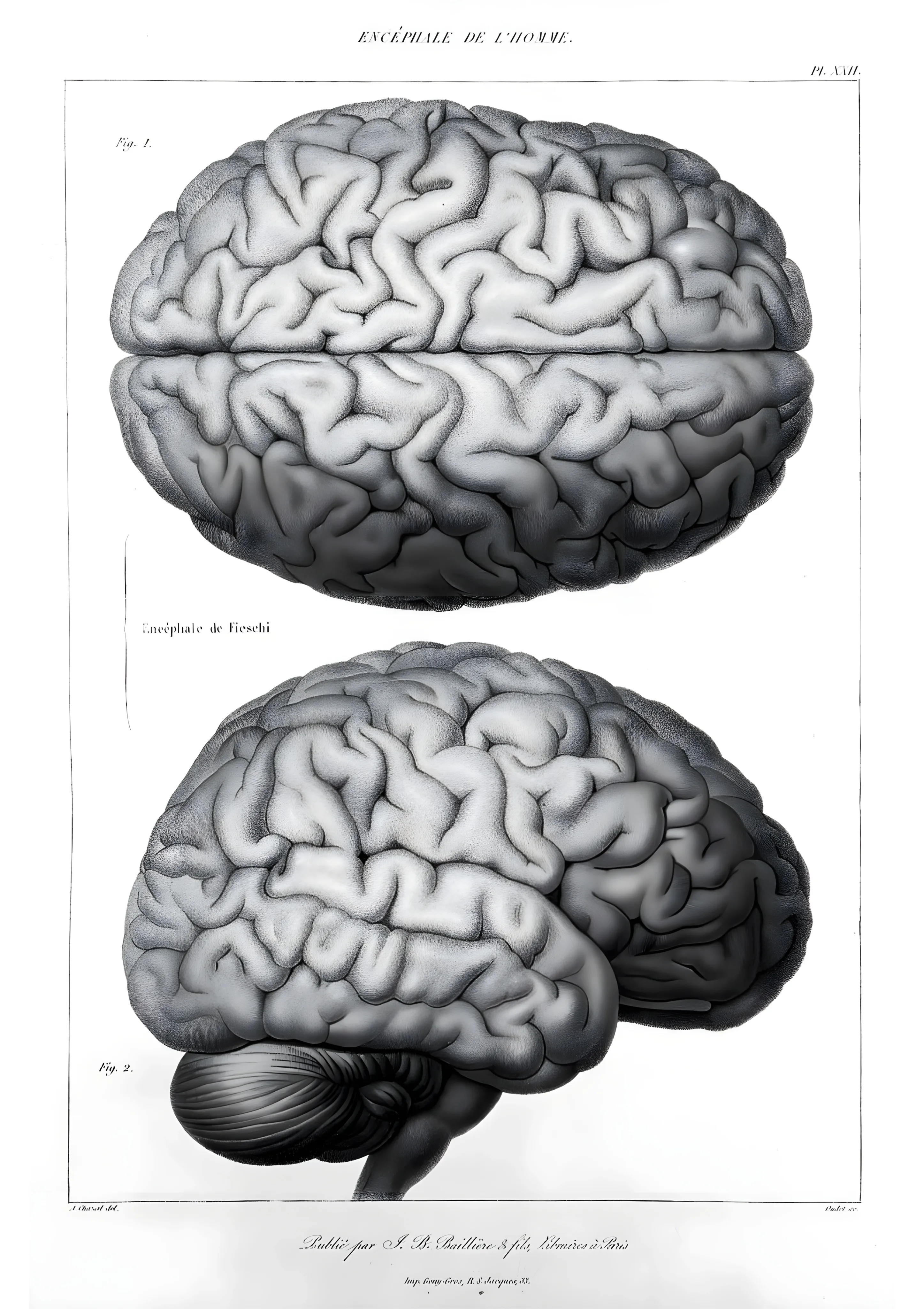 Encephaie de l Homme image 1
