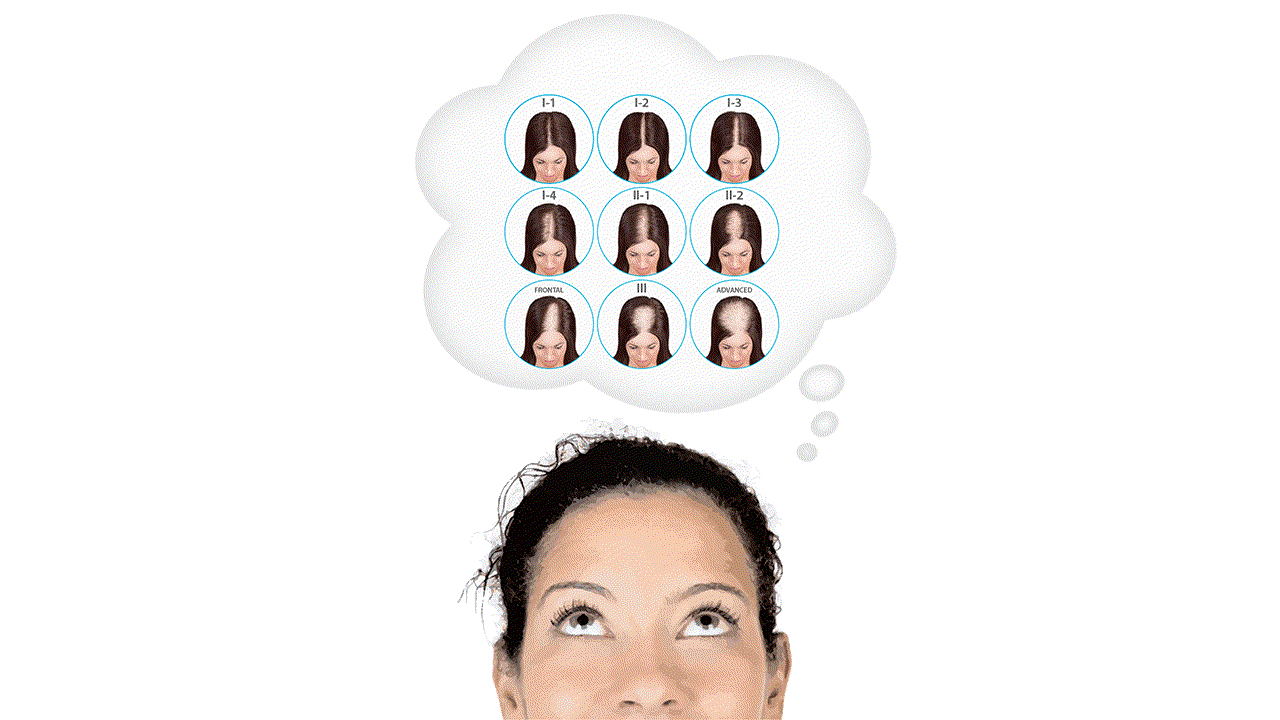 who can benefit from theradome hair growth device