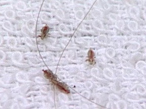 head lice in petri dish