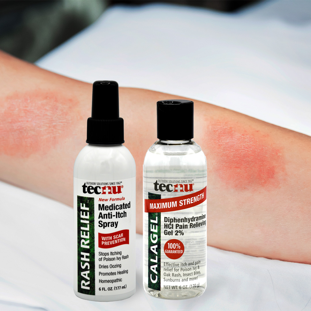 Tecnu Rash Relief and Calagel next to an arm with poison ivy rash