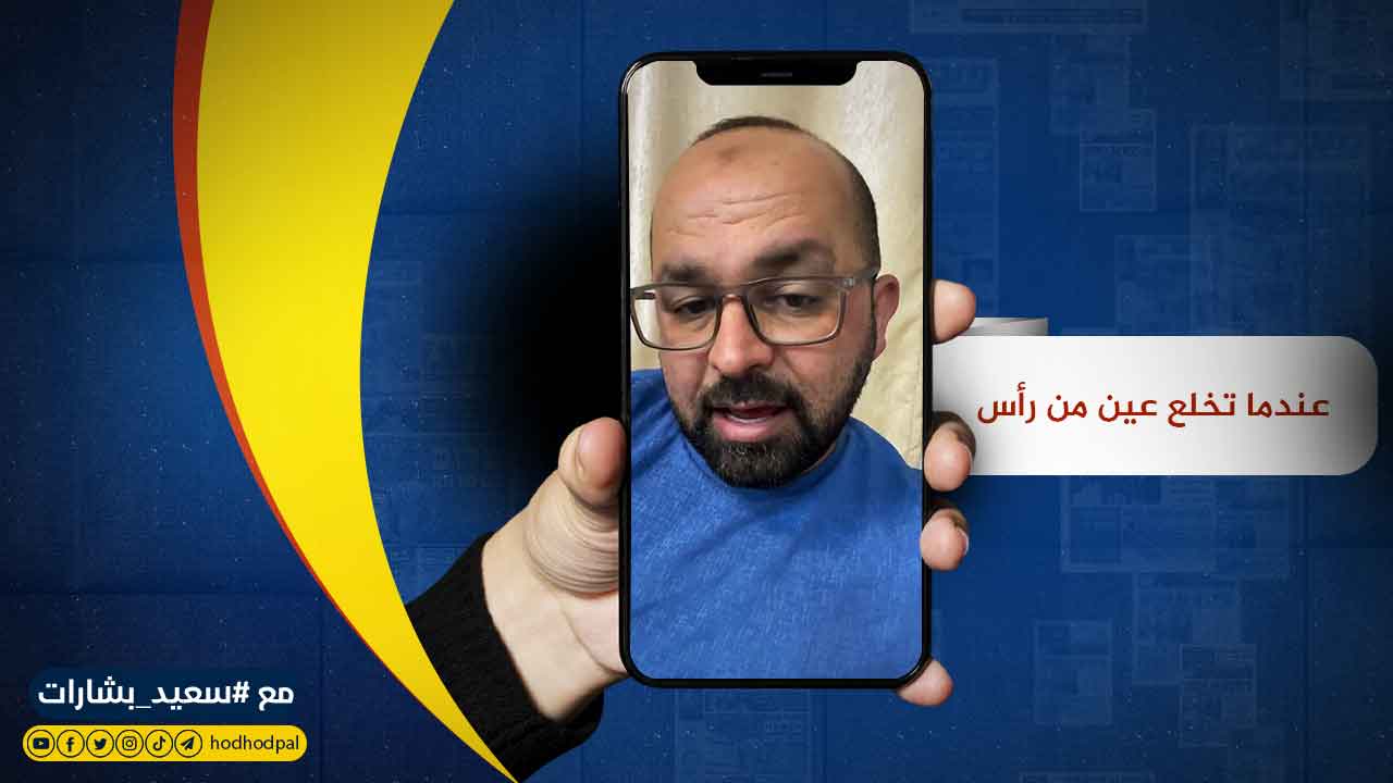 #شاهد: عندما تخلع عينًا من رأس ولا يشعر بها الجسد إلا بعد ثلاثة أيام.. فإن الأمل جلل