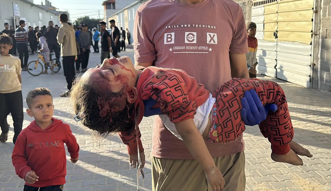 افتتاحية هأرتس: الطفلة التي في هذه الصورة لا نريد أن نراها. إن رأيناها، سنشعر بالذنب