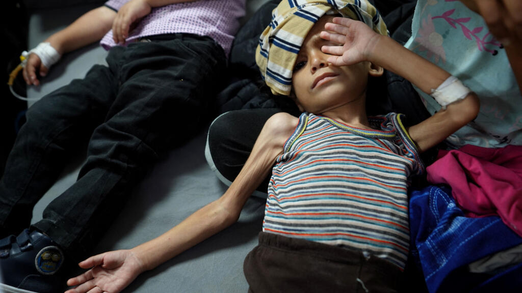 خبراء: إجراءات إسرائيل في قطاع غزة غير كافية ويتطلب علاجا طويل الأمد لمن يعانون من سوء التغذية