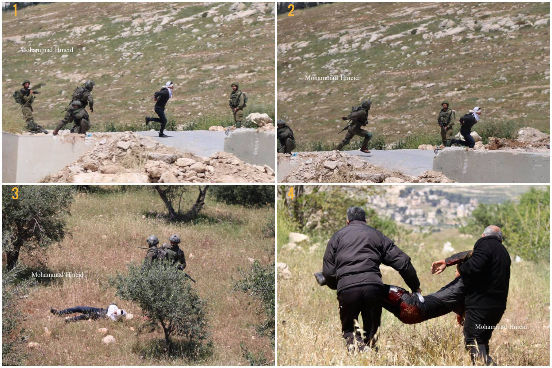 A Palestinian boy shot by IOF, severely injured, as he tried to escape detention