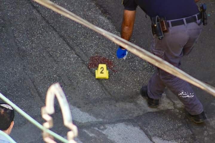 In Video and Pictures| Israeli soldiers critically wound young girl in Hebron