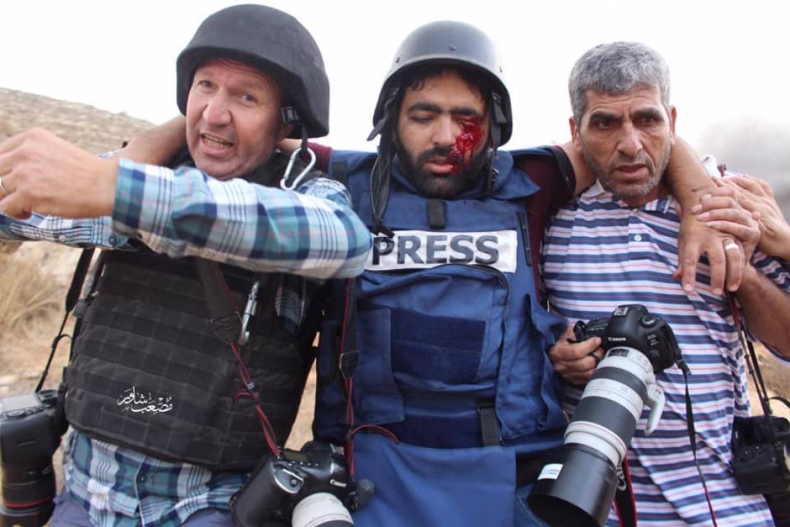 Israeli soldiers shoot journalist in the eye while on duty